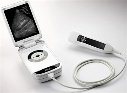 ge-vscan-ultrasound.jpg